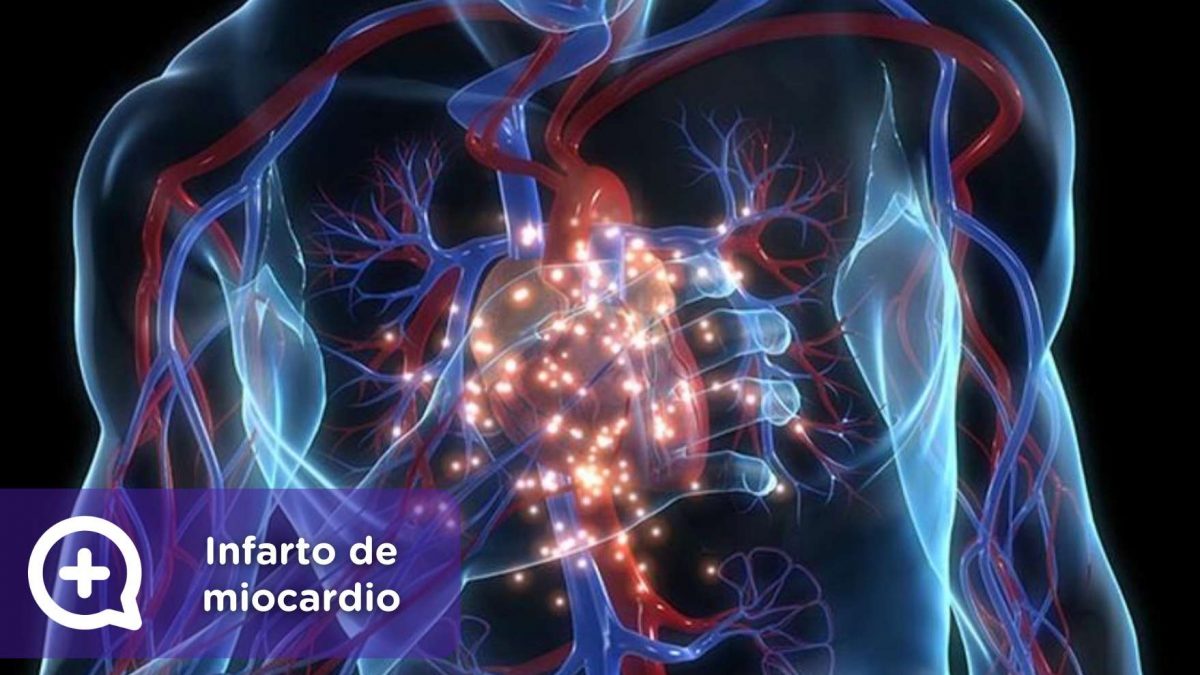 infarto de miocardio, salud, mediquo, angina de pecho, corazón, telemedicina, app, chat medico.