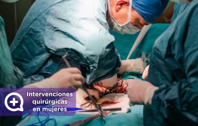 Histerectomía, salud femenina, deseo sexual, ginecología, mujer. Mediquo, tu amigo médico, chat médico.