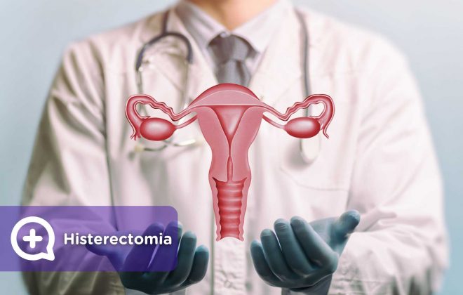 Histerectomia, saúde feminina, deseo sexual, ginecología, mujer. Mediquo, tu amigo médico, chat médico.