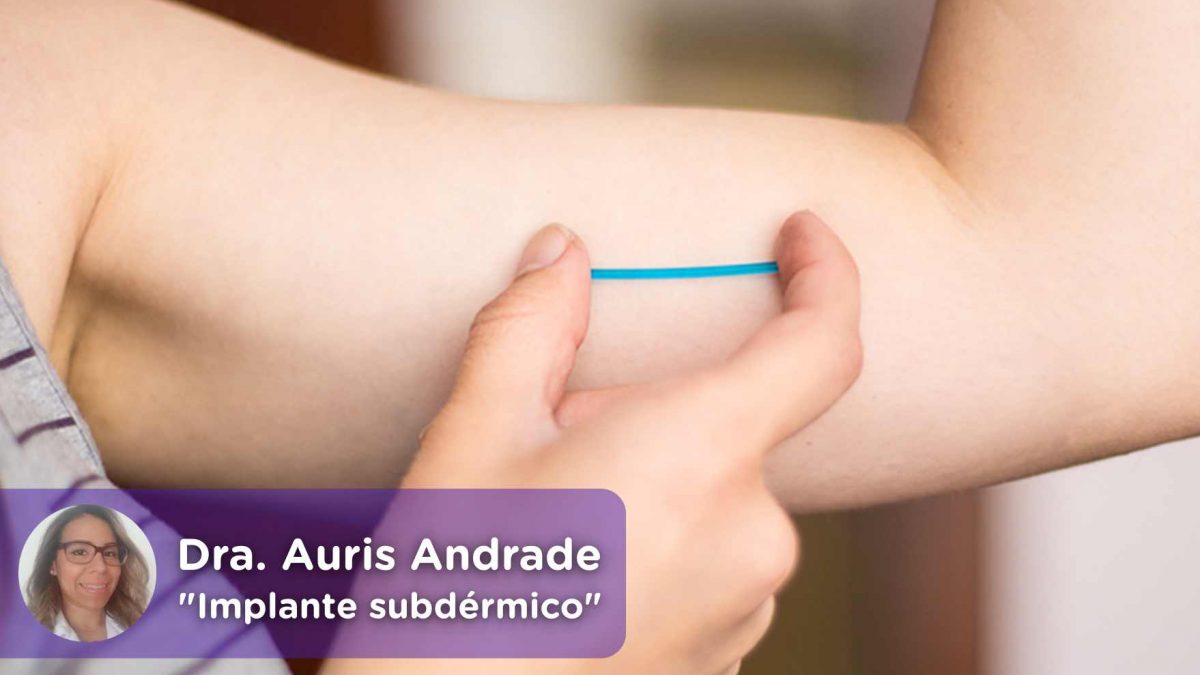 Implante subdérmico, implante, método contraceptivo, efeitos colaterais, médico, saúde, ginecologia,