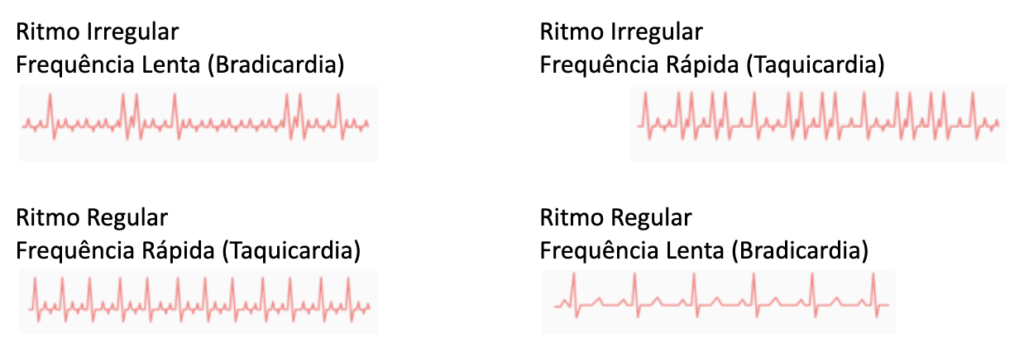 ritmos morte subita