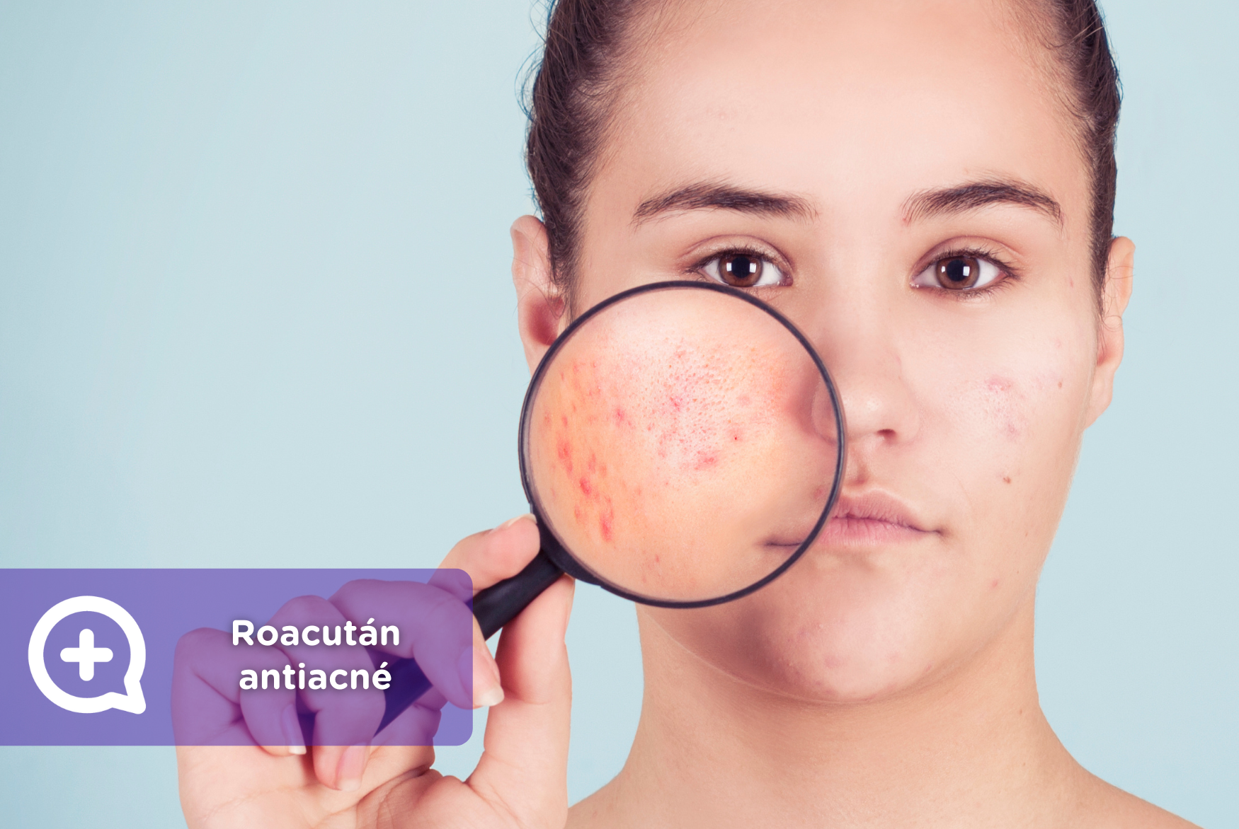precio de pastillas roacutan