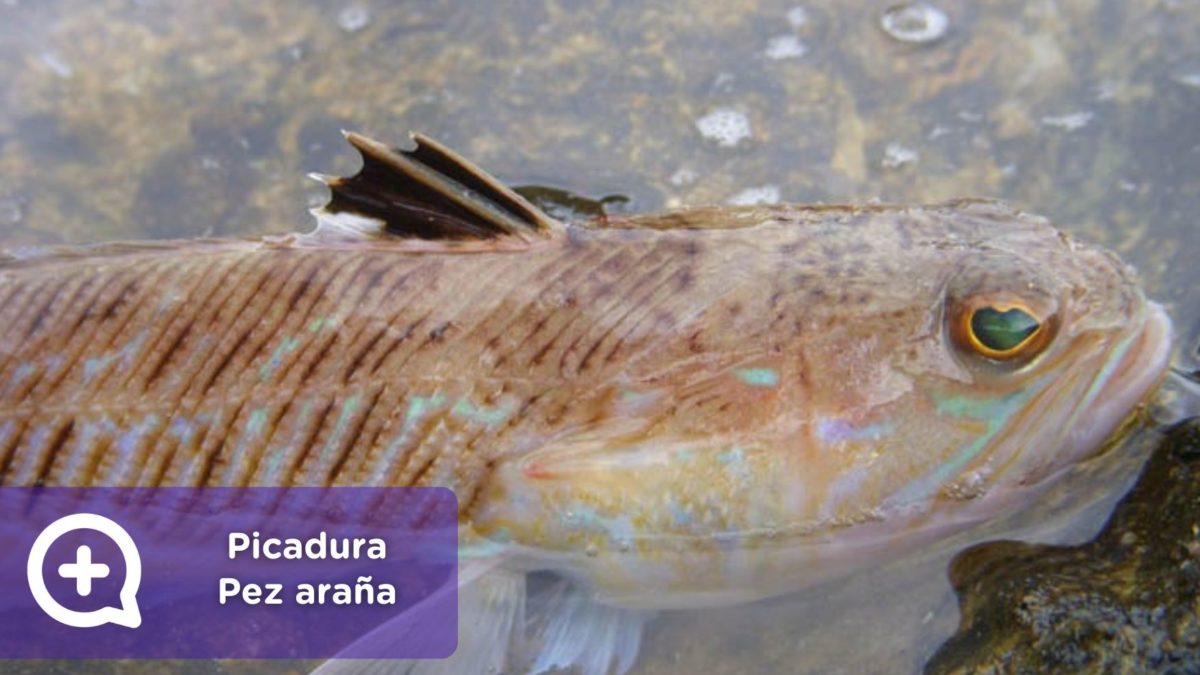 Picadura Pez araña. Síntomas y tratamiento.