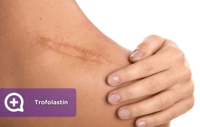 Trofolastín. Producto dermatológico. Heridas. Cicatriz. Salud. MediQuo.