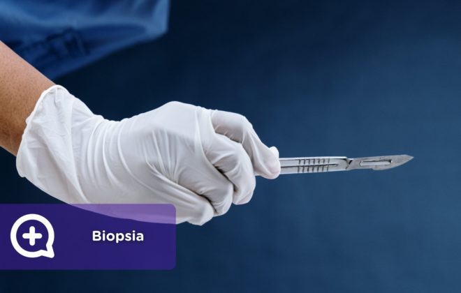 Biopsia. Guia completa. MediQuo. Cáncer