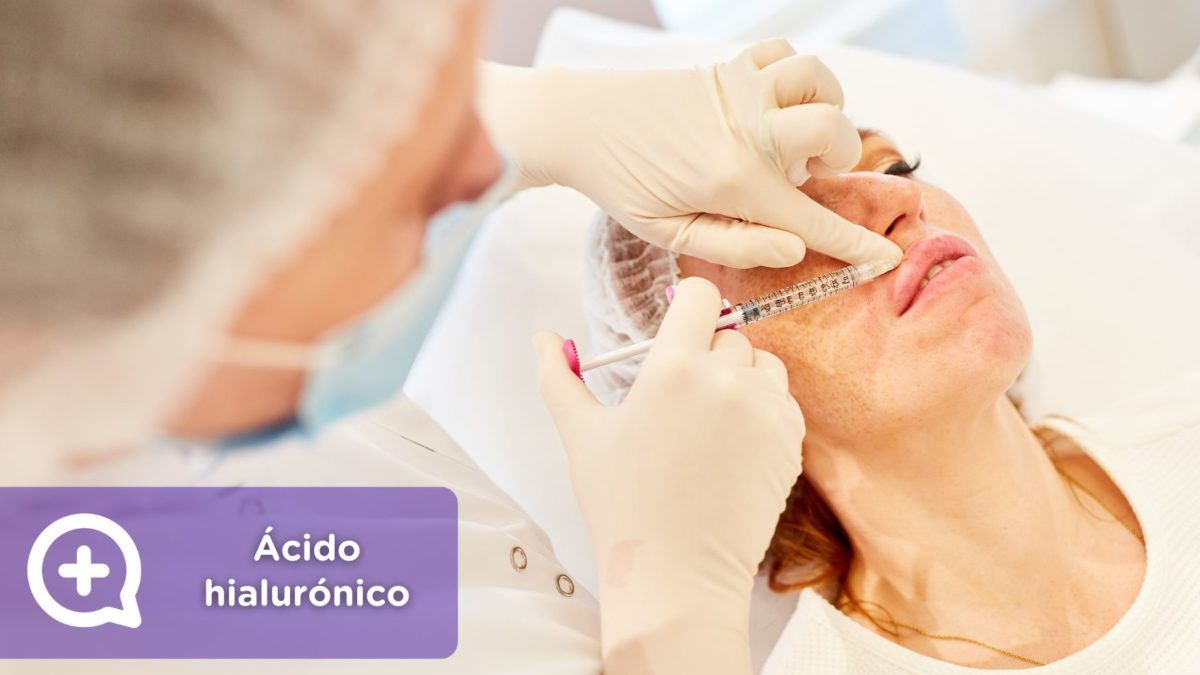 Ácido hialurónico. Arrugas. Medicina estética. MediQuo.