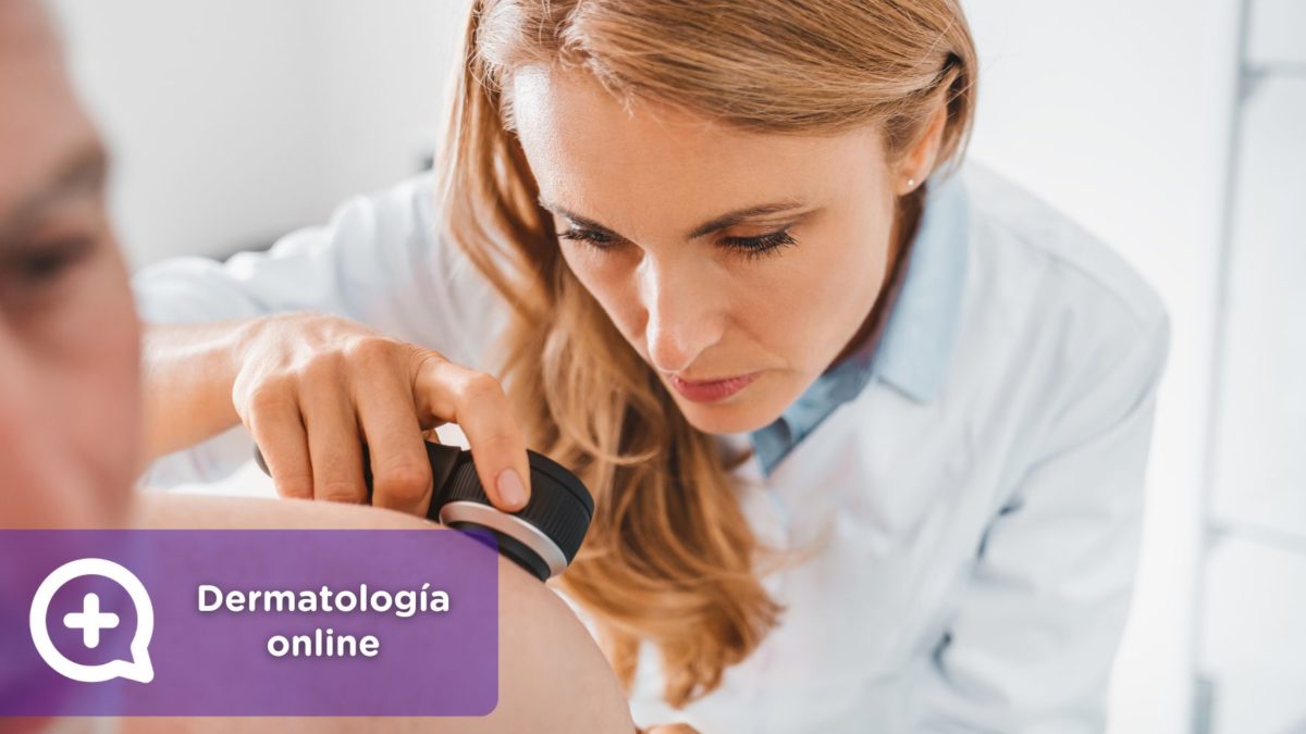 dermatología online. teledermatología. Consulta por chat. MediQuo