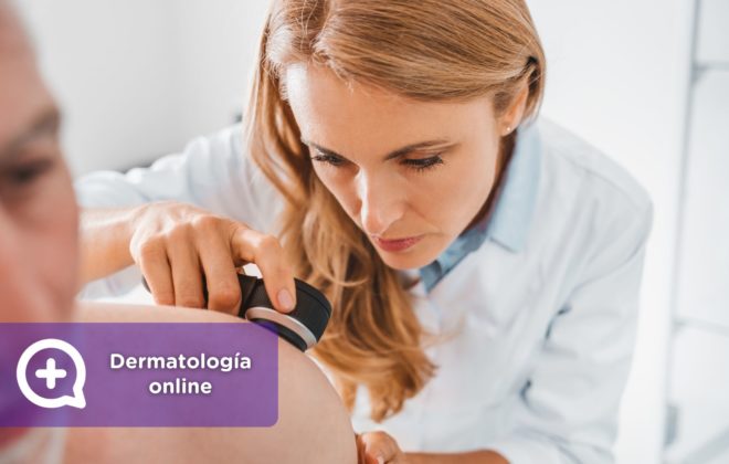 dermatología online. teledermatología. Consulta por chat. MediQuo