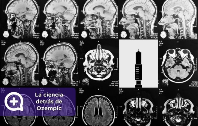 Ciencia y Ozempic. Pérdida de peso. Receta médica.