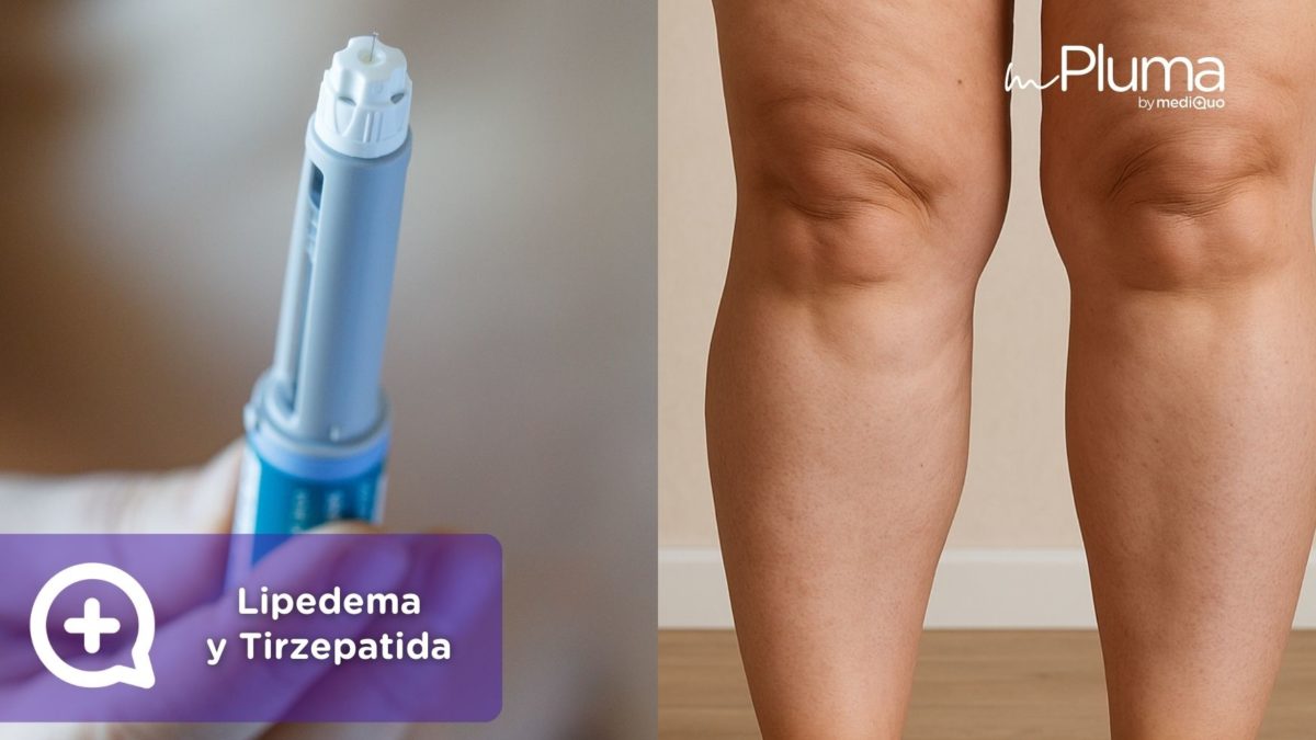 Lipedema y tirzepatida síntomas, tratamiento y nuevas esperanzas para las pacientes en España